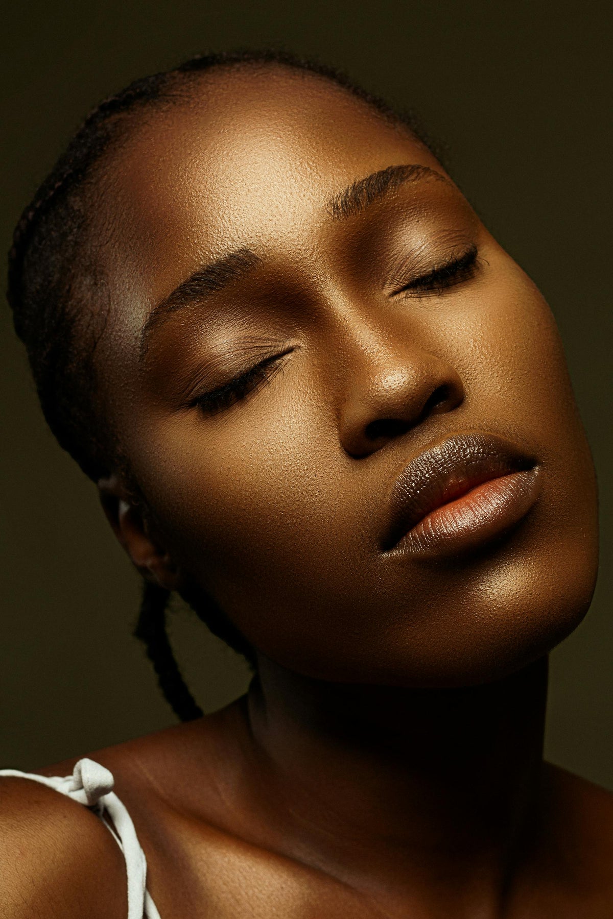 Taches & hyperpigmentation